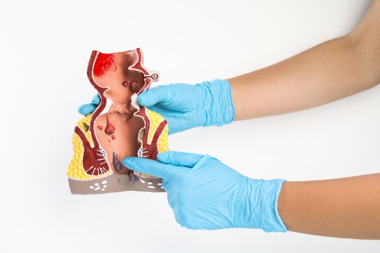 Kohinoor Piles Injection Clinic