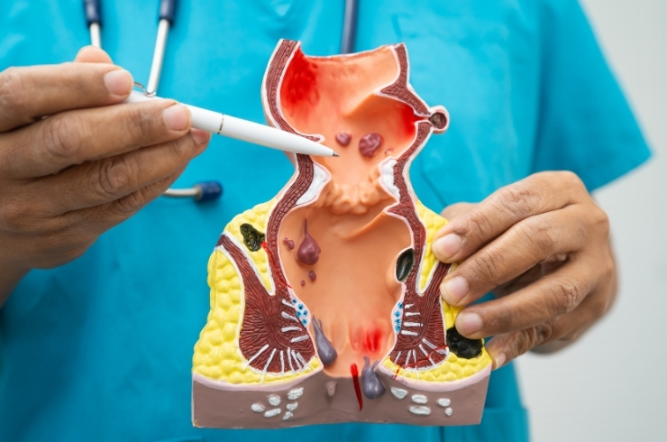Kohinoor Piles Injection Clinic
