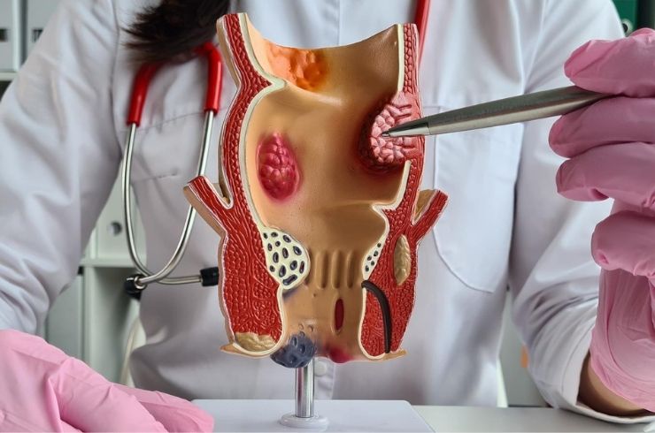 Kohinoor Piles Injection Clinic